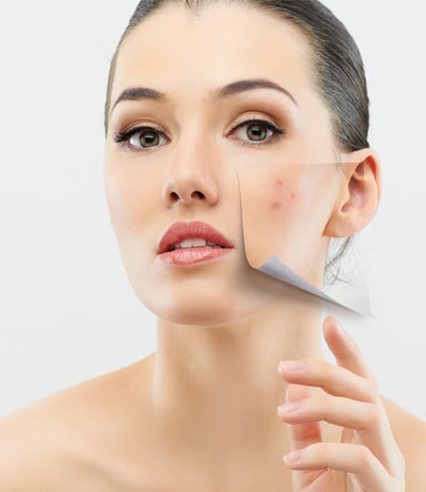 Özel Elos Lazer Polikliniği - Kızılay - 10. Fotoğraf Özel Elos Lazer Polikliniği - Kızılay - 10. Fotoğraf