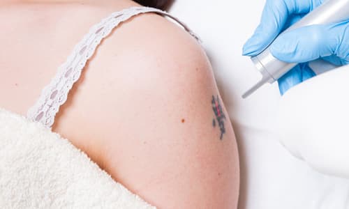 Özel Elos Lazer Polikliniği - Kızılay