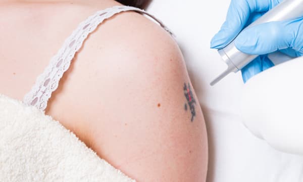 Özel Elos Lazer Polikliniği - Kızılay - 11. Fotoğraf Özel Elos Lazer Polikliniği - Kızılay - 11. Fotoğraf