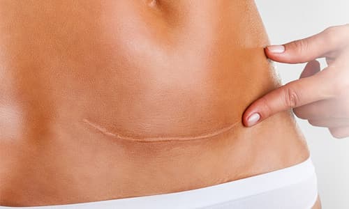 Özel Elos Lazer Polikliniği - Kızılay