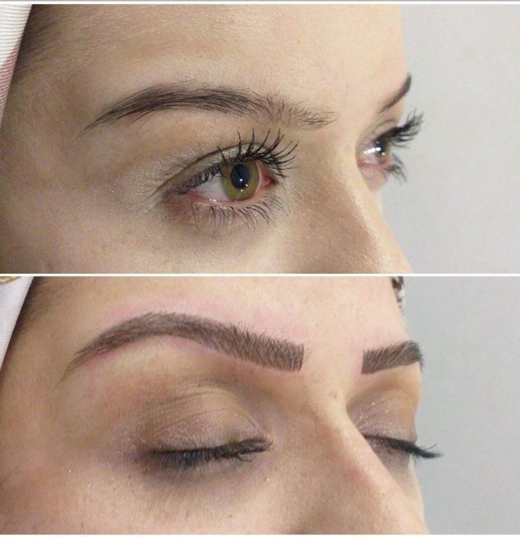 Estemedic Güzellik Merkezi - 3. Fotoğraf