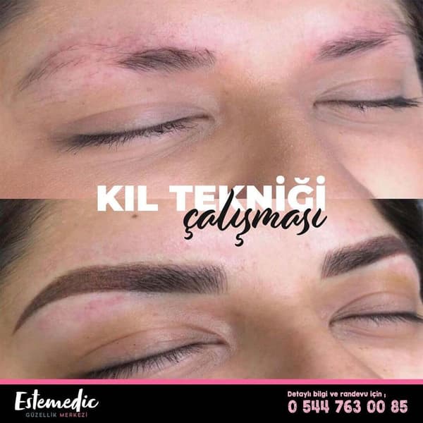 Estemedic Güzellik Merkezi - 6. Fotoğraf Estemedic Güzellik Merkezi - 6. Fotoğraf