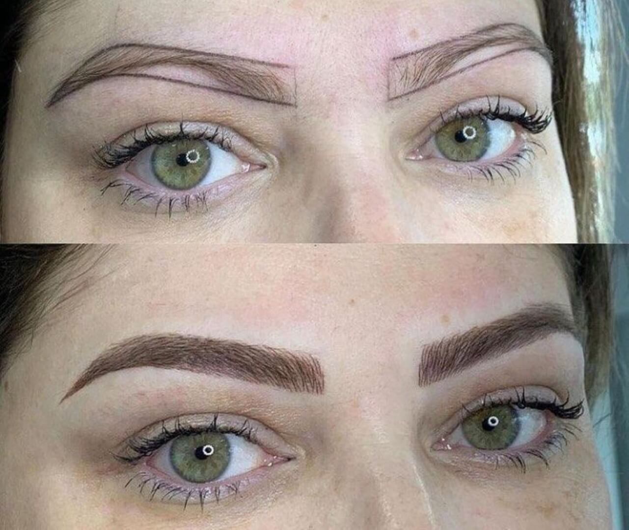 Estemedic Güzellik Merkezi - 4. Fotoğraf