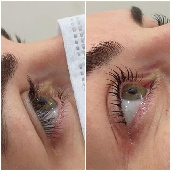 Estemedic Güzellik Merkezi - 2. Fotoğraf Estemedic Güzellik Merkezi - 2. Fotoğraf