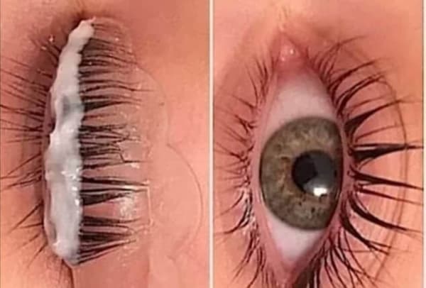 Estemedic Güzellik Merkezi - 7. Fotoğraf Estemedic Güzellik Merkezi - 7. Fotoğraf