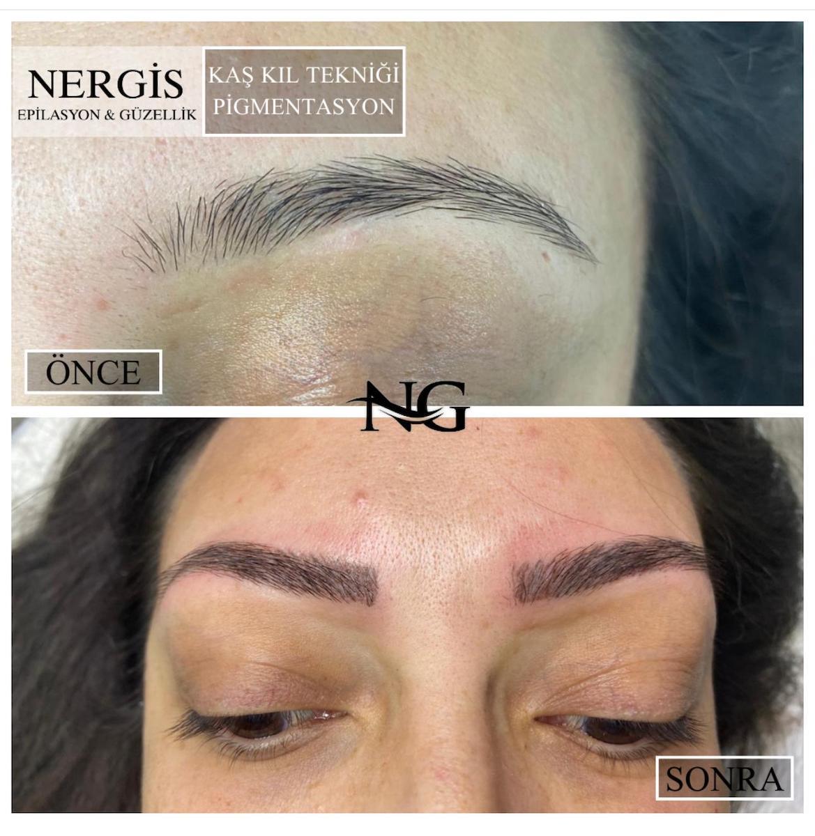 Nergis Epilasyon ve Güzellik