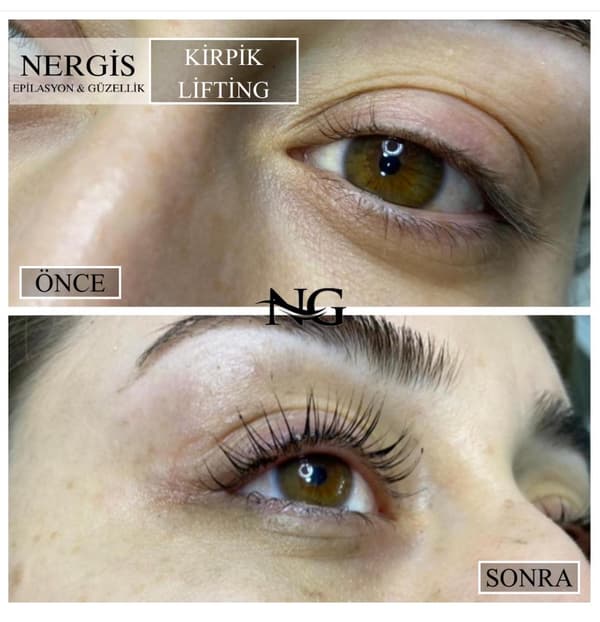 Nergis Epilasyon ve Güzellik - 2. Fotoğraf Nergis Epilasyon ve Güzellik - 2. Fotoğraf