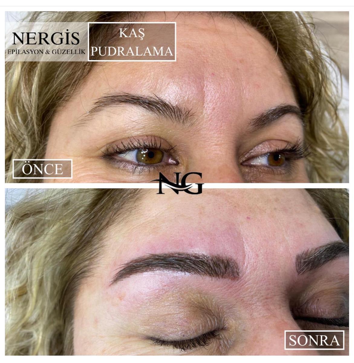 Nergis Epilasyon ve Güzellik