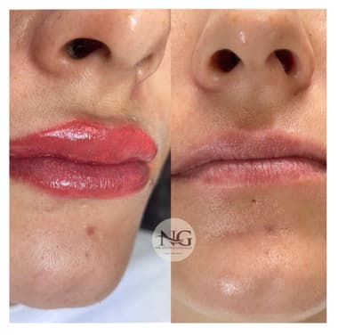 Nergis Epilasyon ve Güzellik