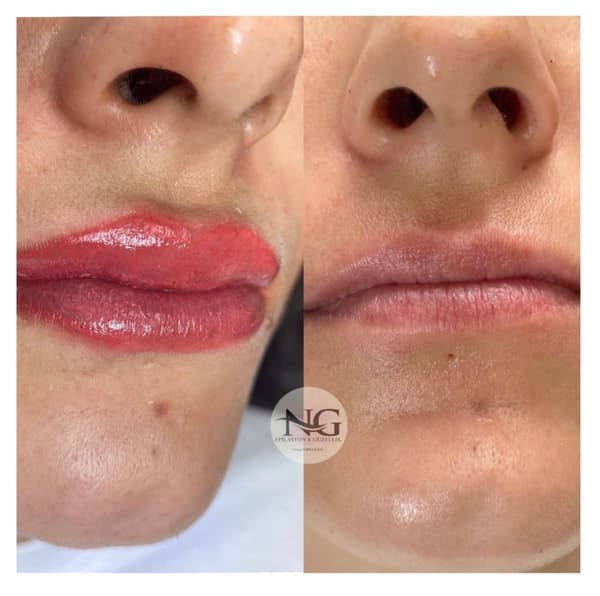 Nergis Epilasyon ve Güzellik - 1. Fotoğraf Nergis Epilasyon ve Güzellik - 1. Fotoğraf