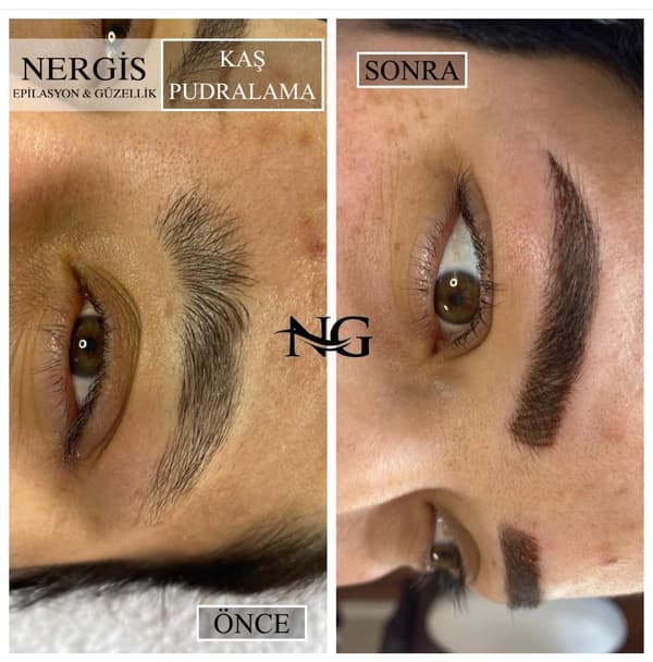 Nergis Epilasyon ve Güzellik - 4. Fotoğraf Nergis Epilasyon ve Güzellik - 4. Fotoğraf