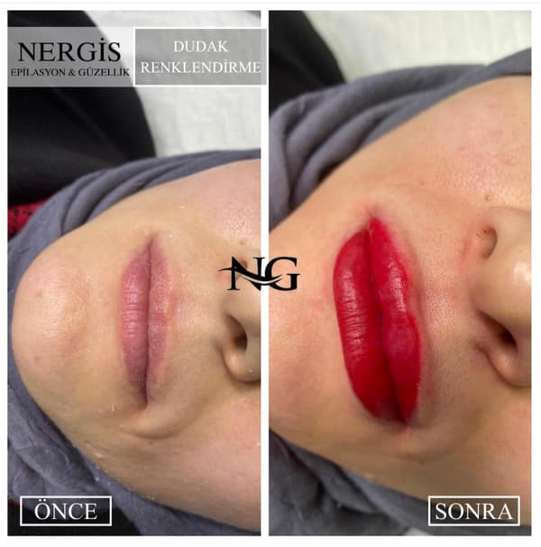 Nergis Epilasyon ve Güzellik - 11. Fotoğraf Nergis Epilasyon ve Güzellik - 11. Fotoğraf