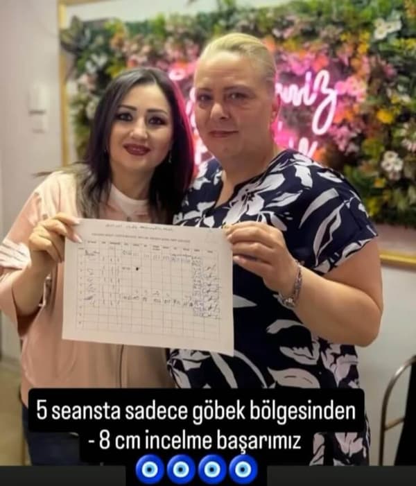 Esin Deniz Beauty - 4. Fotoğraf Esin Deniz Beauty - 4. Fotoğraf