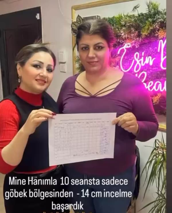 Esin Deniz Beauty - 6. Fotoğraf Esin Deniz Beauty - 6. Fotoğraf