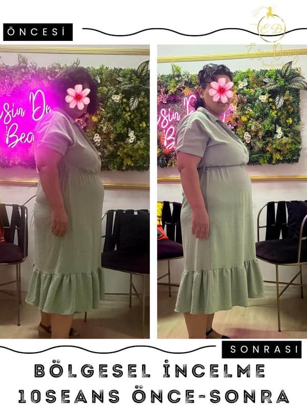 Esin Deniz Beauty - 10. Fotoğraf Esin Deniz Beauty - 10. Fotoğraf