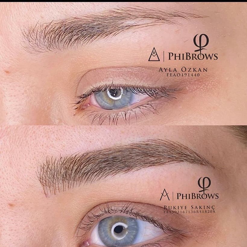 Rukiye Kuba Güzellik Salonu  - Kızılay  Gözenek Sıkılaştırma - 2. Fotoğraf